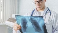 Malaria and Tuberculosis: Global Killers