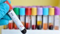 The Deadly Strategy of AIDS