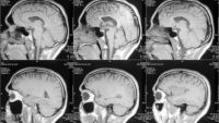 Cortex-Sensory, Motor, and Association Areas