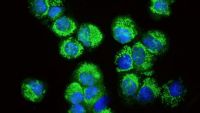 Parkinson's Disease