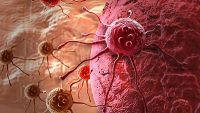 The Biology of Human Cancer