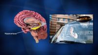 The Benefits of Bilingualism