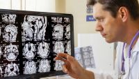 Neuroimaging-The Sensory Brain at Work