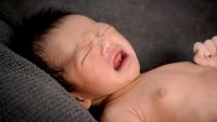 Sleep Apnea