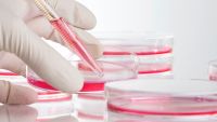 How Do We Know If Something Causes Cancer?