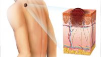 How Tumors Spread and Thrive