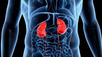 Selling a Kidney