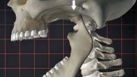 Releasing Jaw Tension
