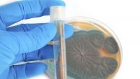 1928-The Discovery of Penicillin