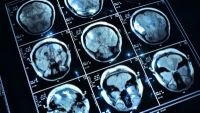 Personality and the Brain